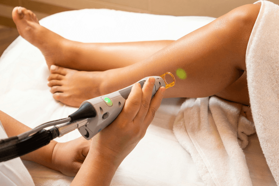 Laser Hair Removal