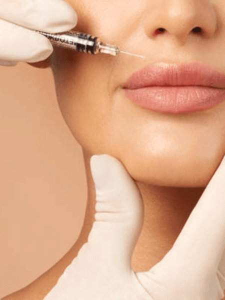 Dermal Fillers