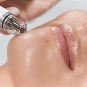 Diamond Glow facial